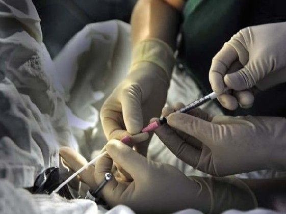借卵试管婴儿的双胞胎是同性吗？什么时候可以选择生双胞胎｜借卵试管婴儿｜双胞胎｜性别