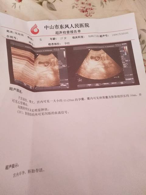 2022年没有结婚证做赠卵试管自怀的私人