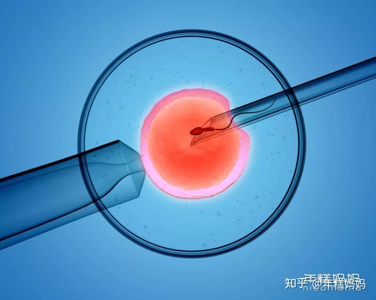 做赠卵借卵代怀试管需要多长时间？怀孕和工作不耽误的策略来了