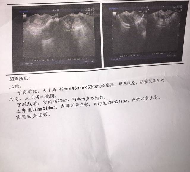做借卵试管婴儿流程步骤图