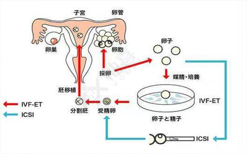 做借卵试管婴儿移植吃什么有助于胚胎着床