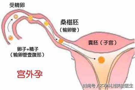 长春做试管费用多少钱
