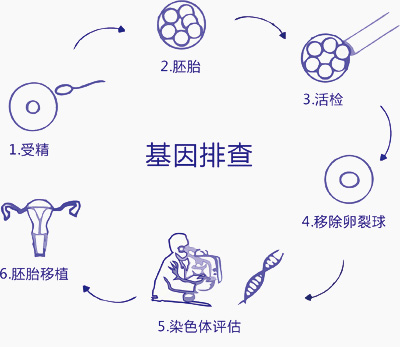 郑大一附院做试管找谁