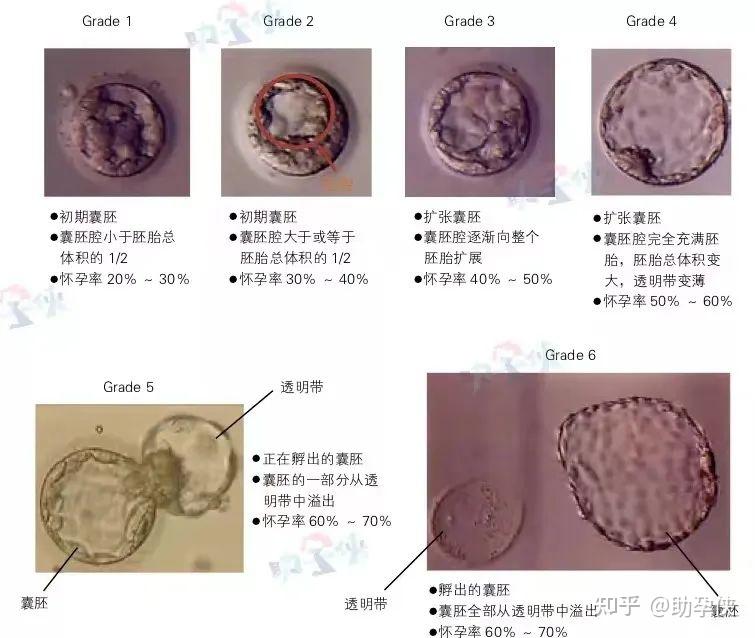 自助行攻略2023年最新吉林二代代怀成功了率高吗费用大揭秘+