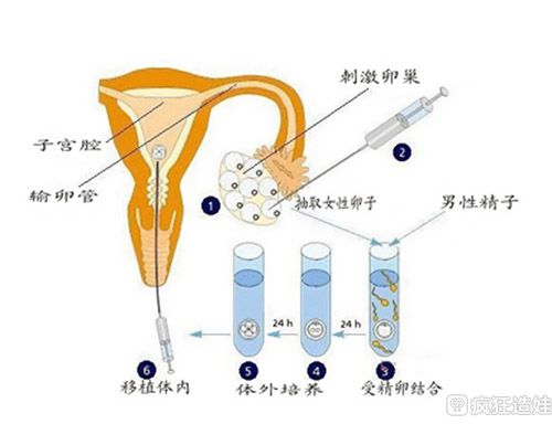 吉林长春先天性免疫抗体阳性做三代同性恋试管代怀费用表的几率多大