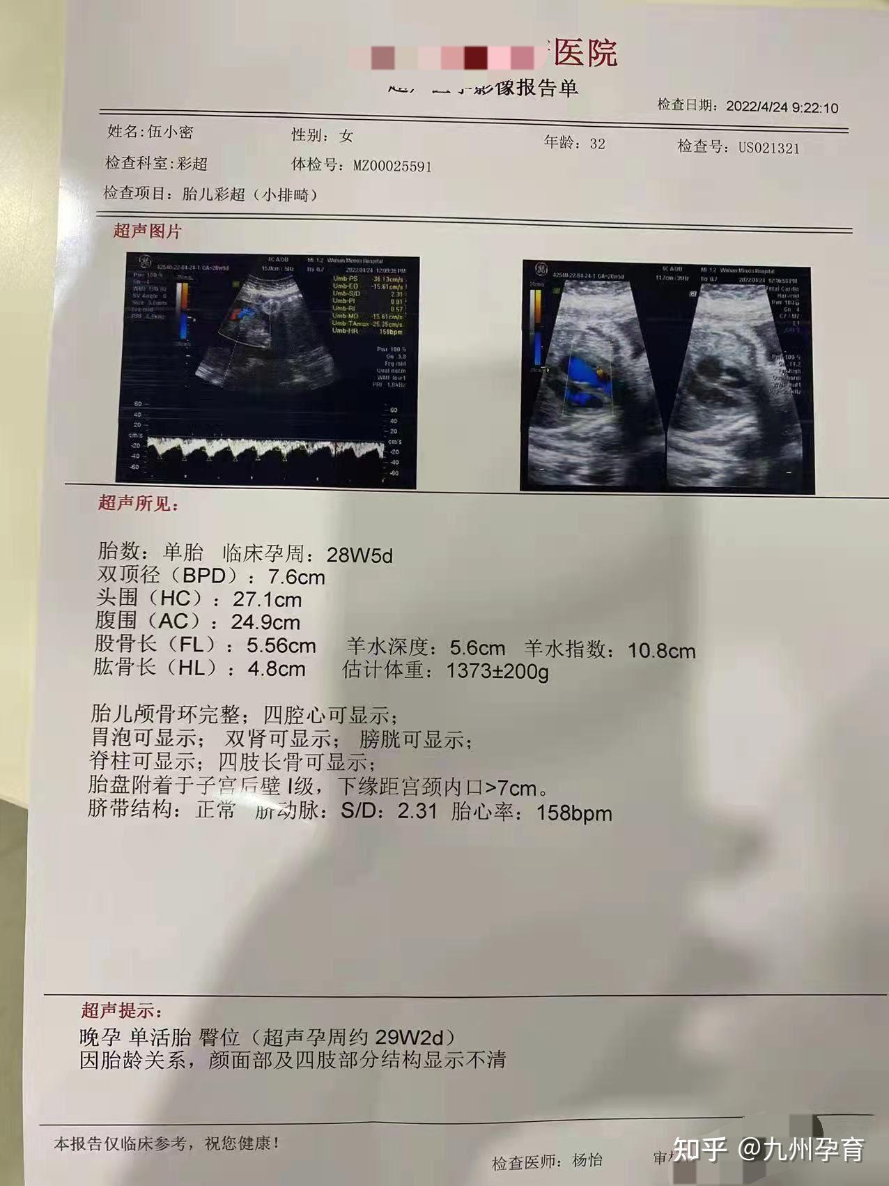 试管取卵之前能同房吗（取卵前不能同房吗）